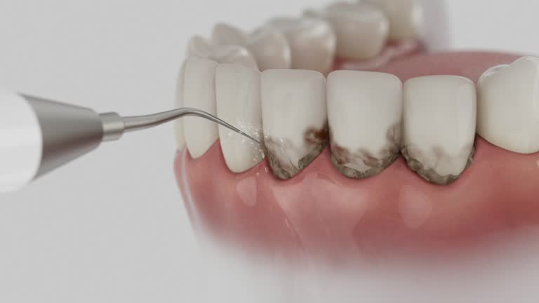 Reliable Dental contractor in Woodville, OH by Dentist Open Now